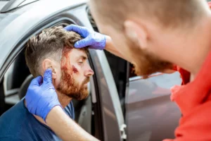 Car Accident Face Injuries and Compensation