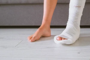 Slip-and-Fall Broken Leg Settlement: What Your Claim May Be Worth